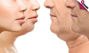 huge_700x420__22751.png